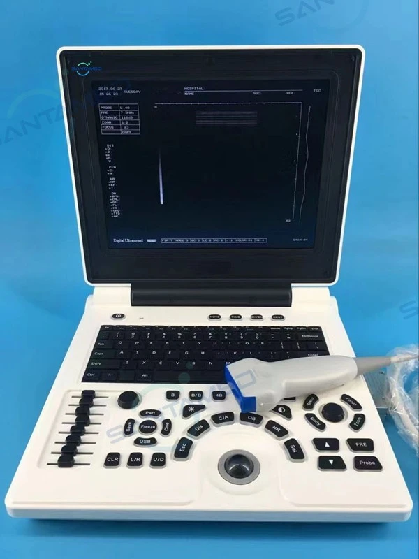 Multi Display Mode Laptop Ultrasound Scanner
